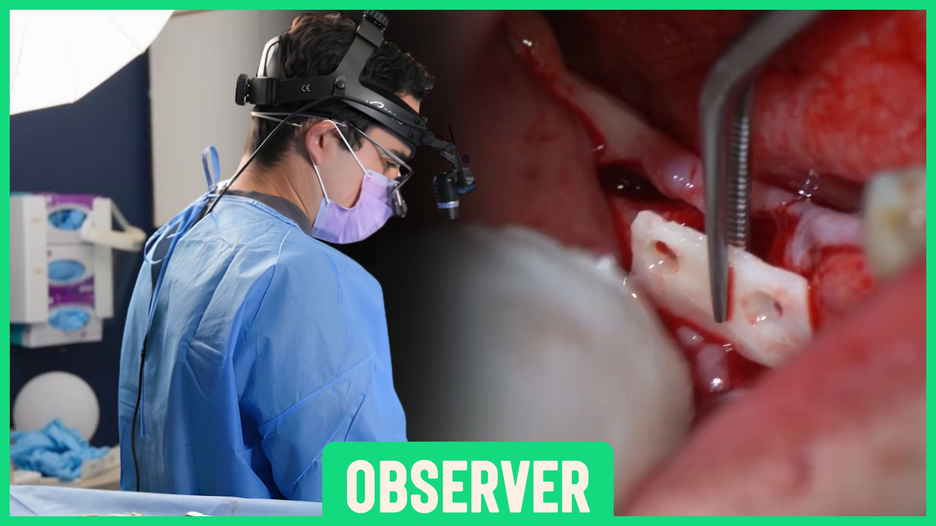 Observer